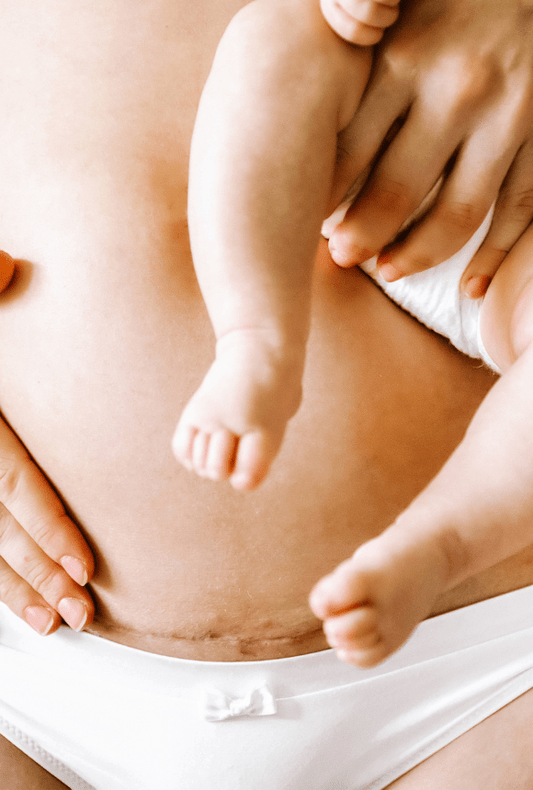 International Caesarean Awareness Month: Tips to Help Take Care of Yourself After a C-section