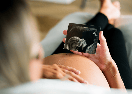 Pregnant Mum with sonogram of her baby